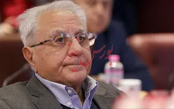 وای اگر تصمیم سخت رئیس جمهور، جراحی ناگهانی نظام بانکی باشد...